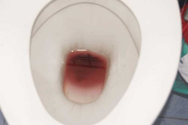 gizonengan antzematea hunkituta dagoenean